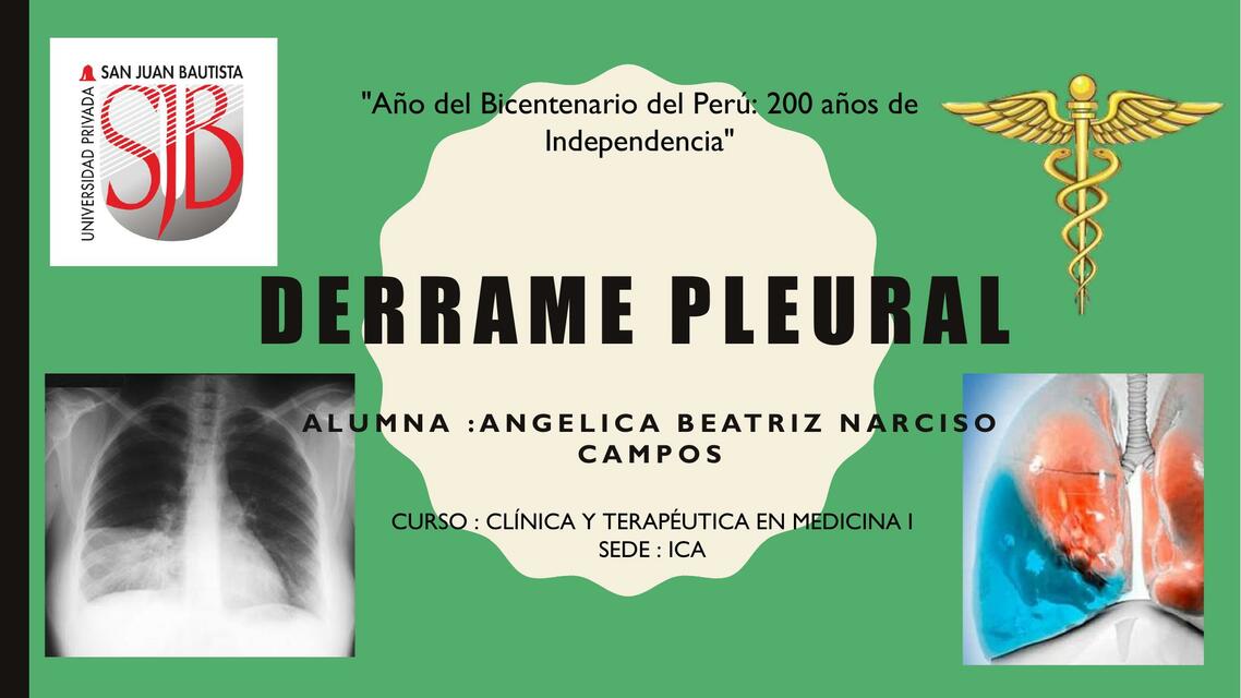 Derrame Pleural 