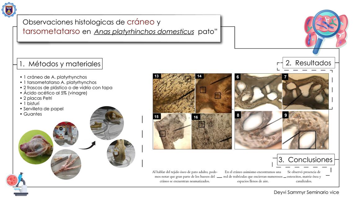 Observación Histológica Ósea del "Pato"