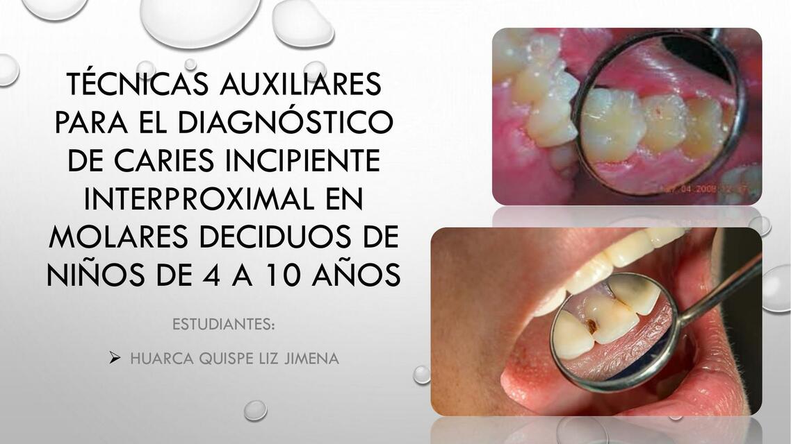 Técnicas Auxiliares para el Diagnóstico de Caries 