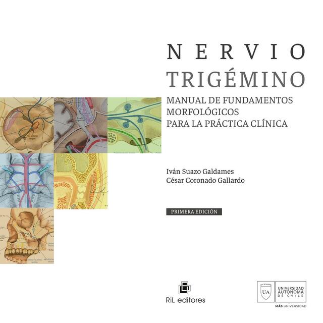 Nervio Trigémino 