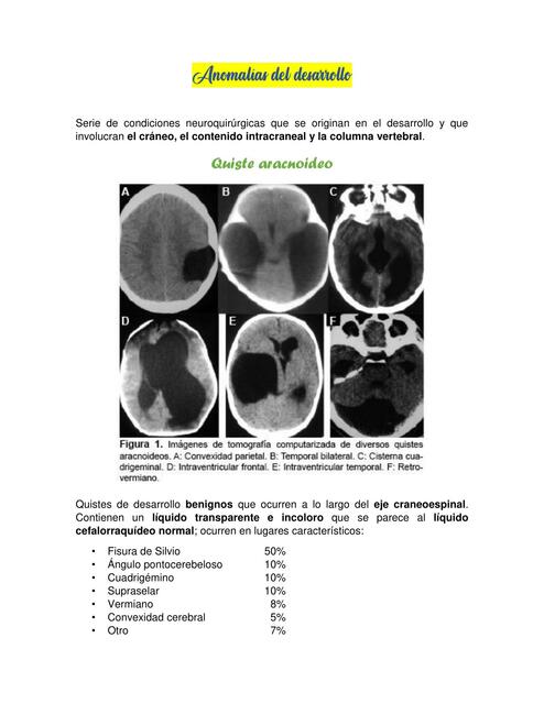 Anormalidades Congénitas