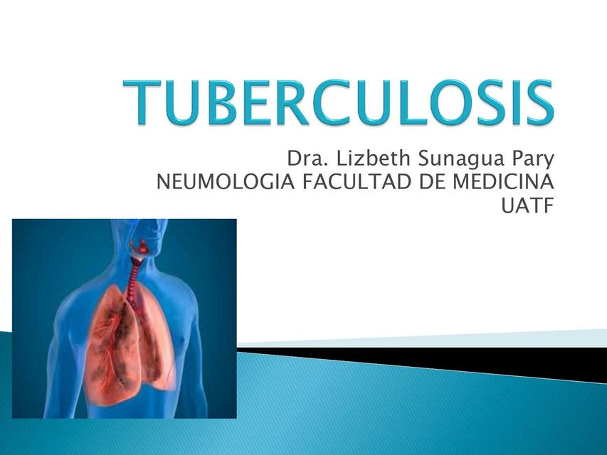 La tuberculosis 