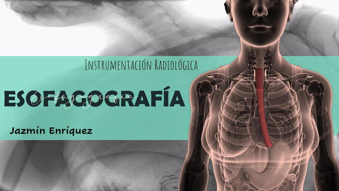 Esofagograma-Esofagografía