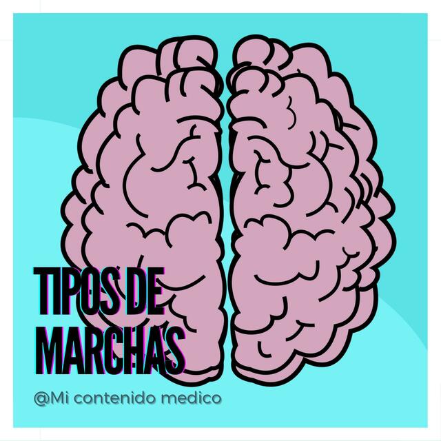 Tipos de Marchas 