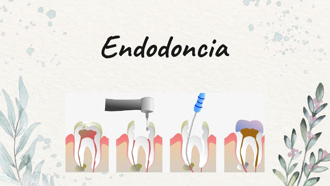 Endodoncia