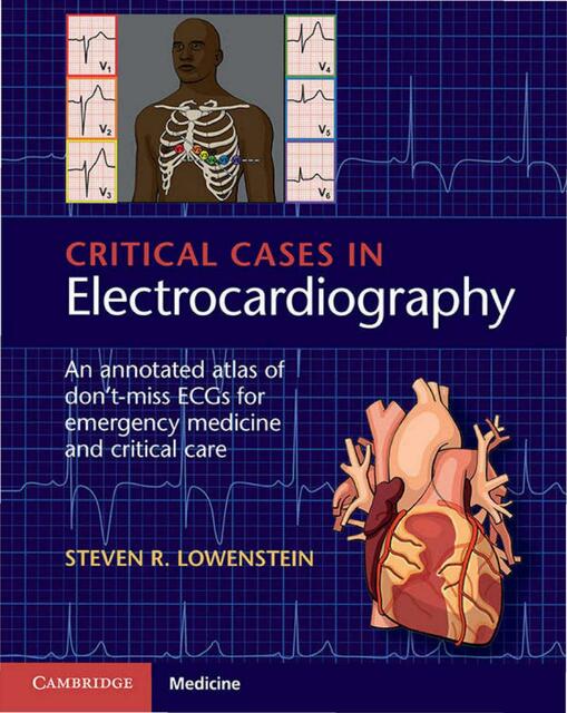 Electrocardiografía 