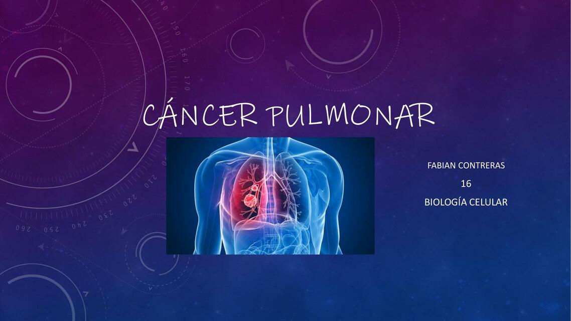 Cáncer Pulmonar