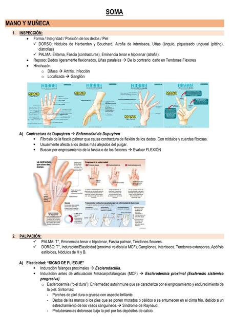 SOMA Mano y Muñeca