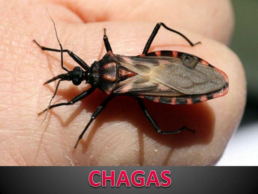 Chagas 