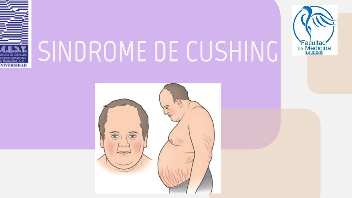 Exposición Oral Síndrome de Cushing