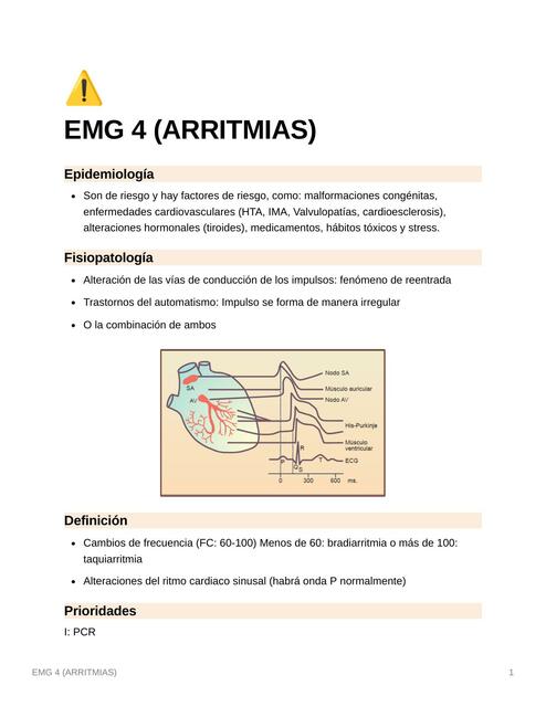 Arritmias