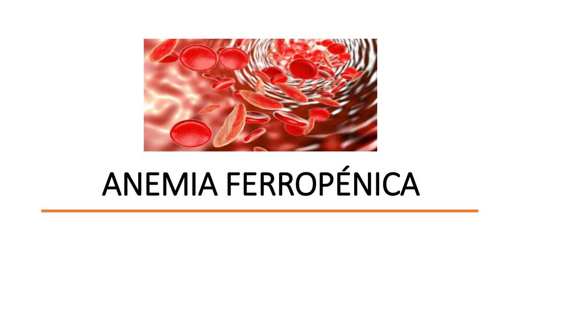 Anemia Ferropénica