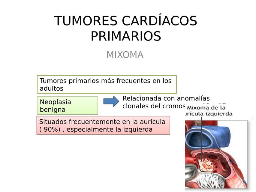 Tumores Cardiacos Primarios