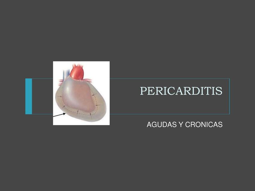 Pericarditis