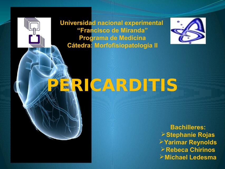 Pericarditis