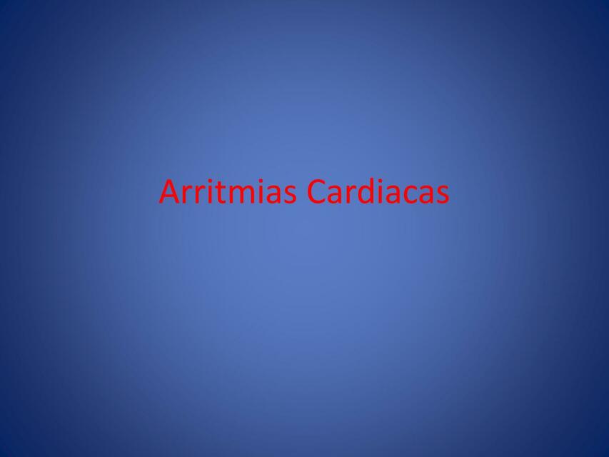 Arritmias Cardiacas