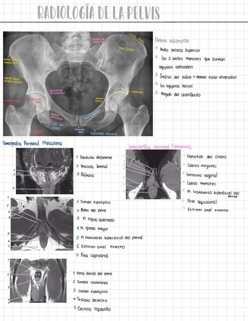 Imágenes Diagnósticas de la Pelvis y Periné