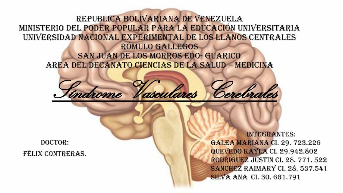 Enfermedad Cerebrovascular