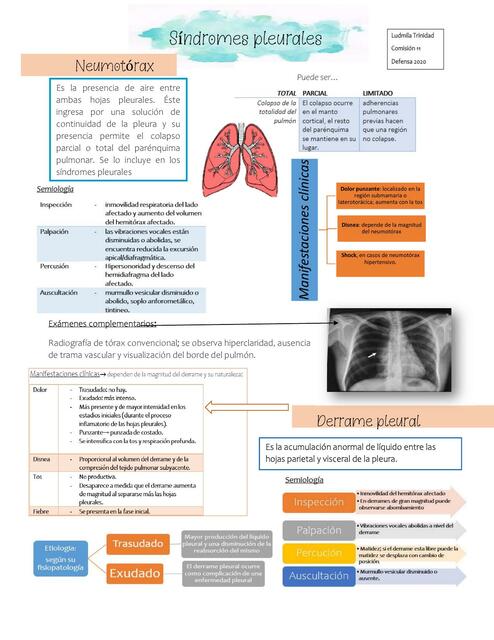 Síndromes Pleurales