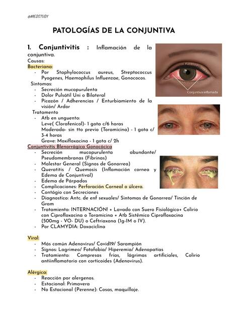 Patologías de la Conjuntiva 