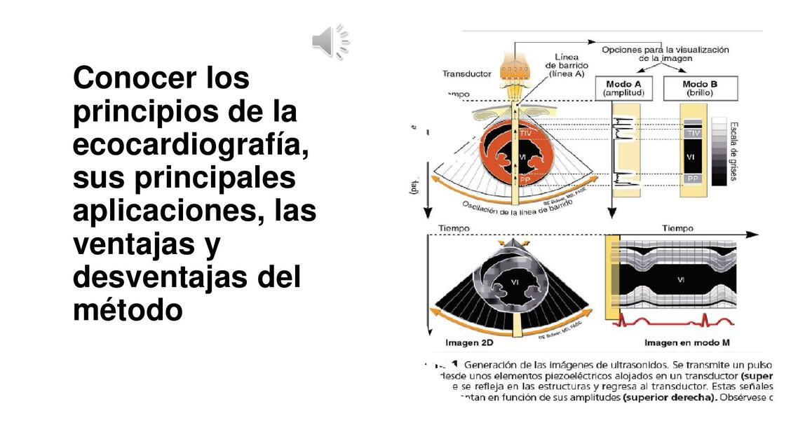 Conocer los Principios de la Ecocardiografía 