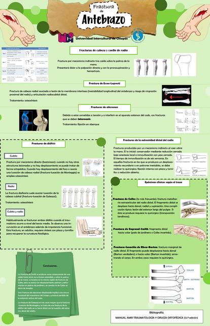Fractura de Antebrazo
