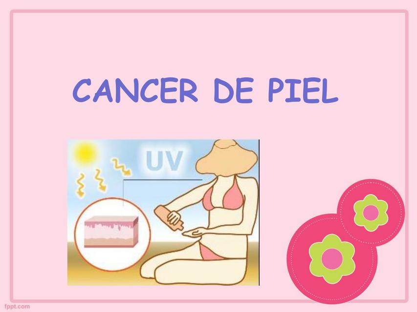 Cáncer de Piel