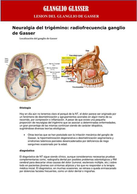 Ganglio de Glasser