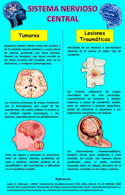 Infográfia Sistema Nervioso Central