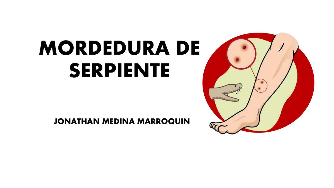 Mordedura de Serpiente