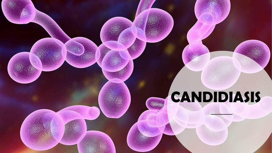 Candidiasis