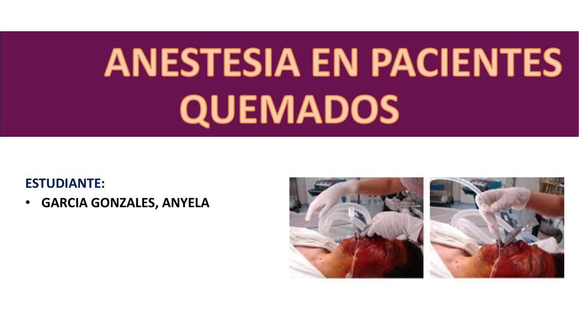 Anestesias en Pacientes Quemados