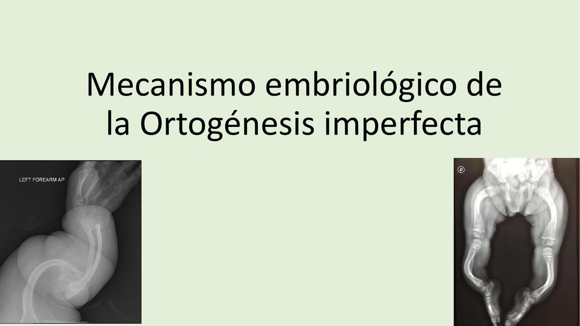 Mecanismo Embriológico de la Ortogénesis Imperfecta