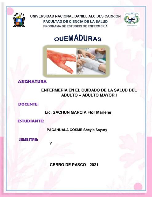 Quemaduras