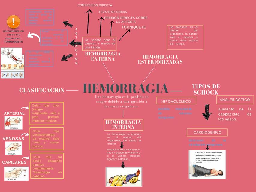 Hemorragia 