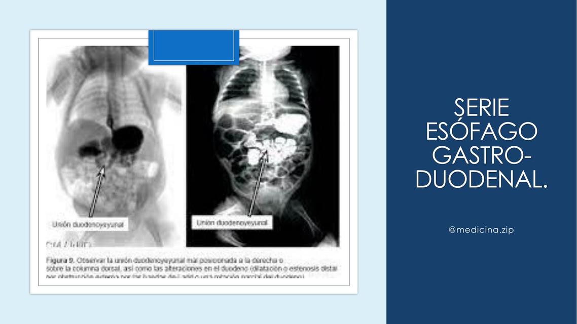 Serie esófago gastro duodenal Imagenología Medicina.zip uDocz