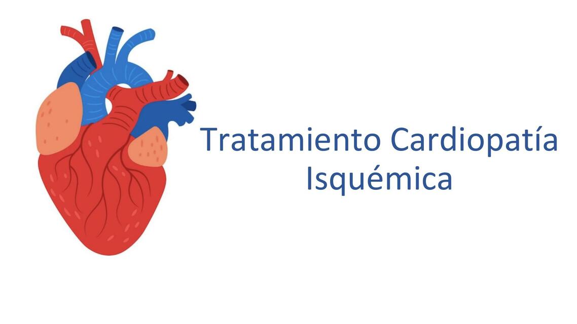 Tratamiento de Cardiopatía Isquémica