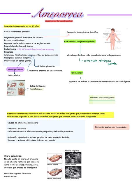 Amenorrea