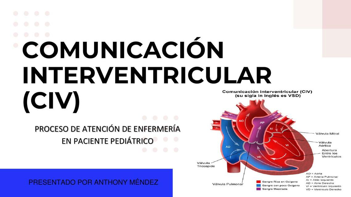 Comunicación Interventricular 