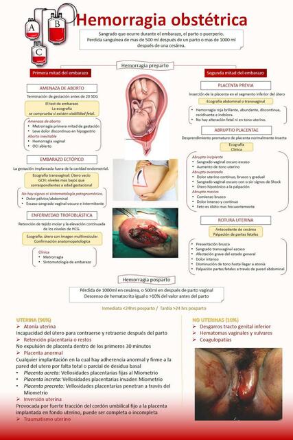 Hemorragia Obstétrica 