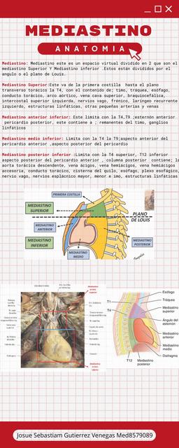 Mediastino 