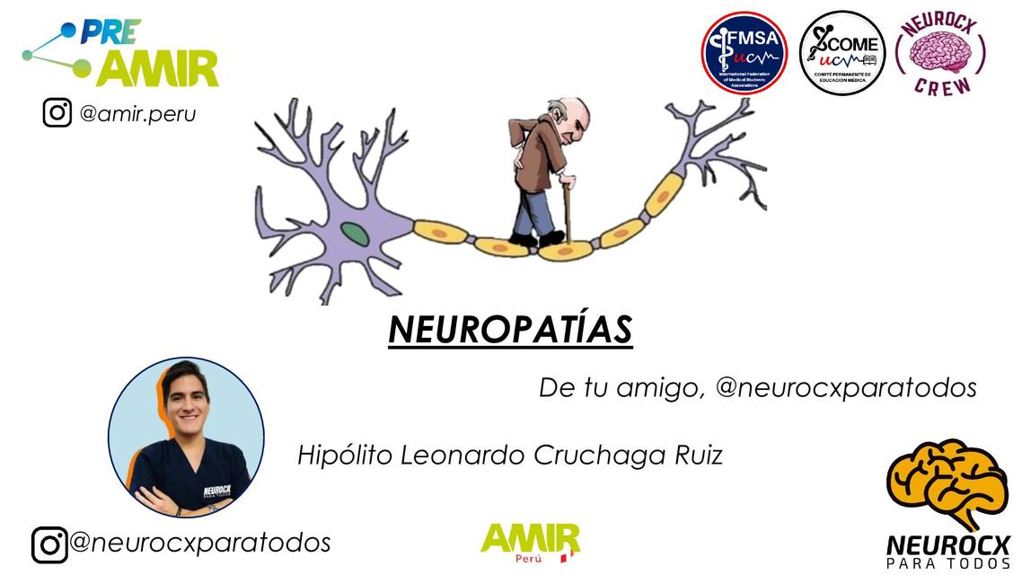 Neuropatías