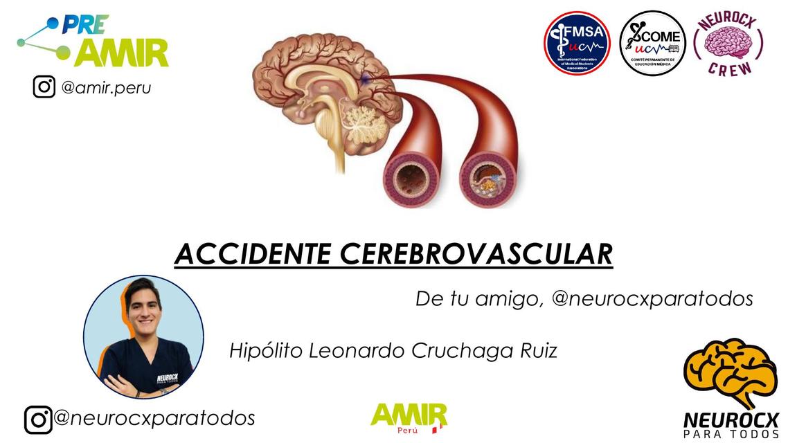 Accidente cerebrovascular