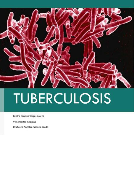 Tuberculosis