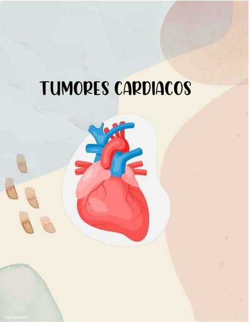 Tumores Cardiacos 