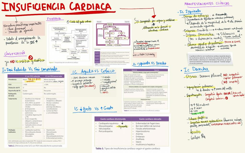 Insuficiencia Cardíaca