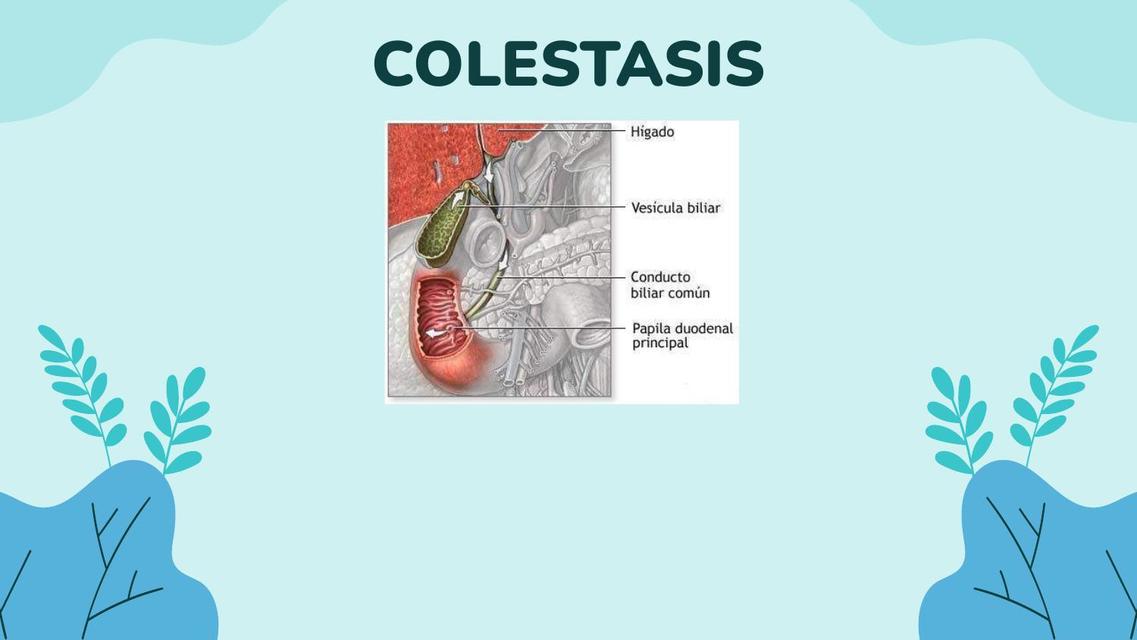 Colestasis