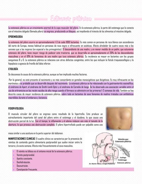 Estenosis Pilórica