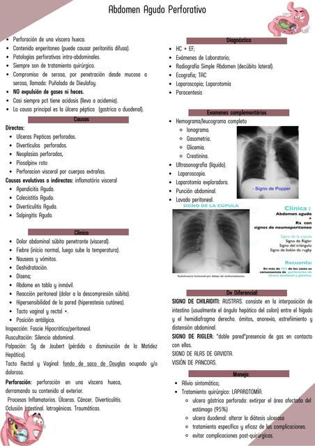 Abdomen Agudo Perforativo 