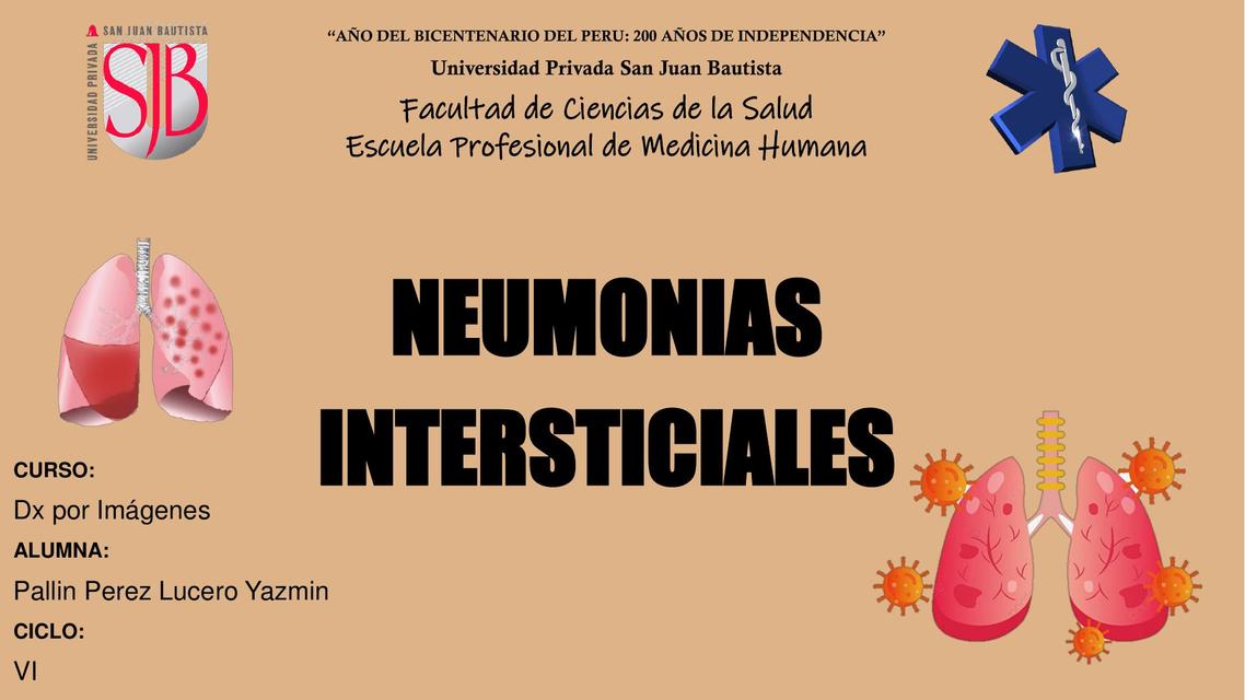 Neumonias Intersticiales